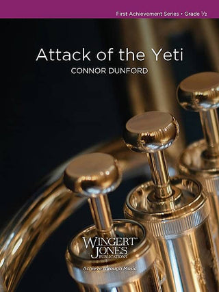 Attack of the Yeti par Connor Dunford